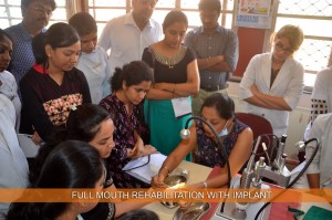 FULL MOUTH REHABILITATION WITH IMPLANT